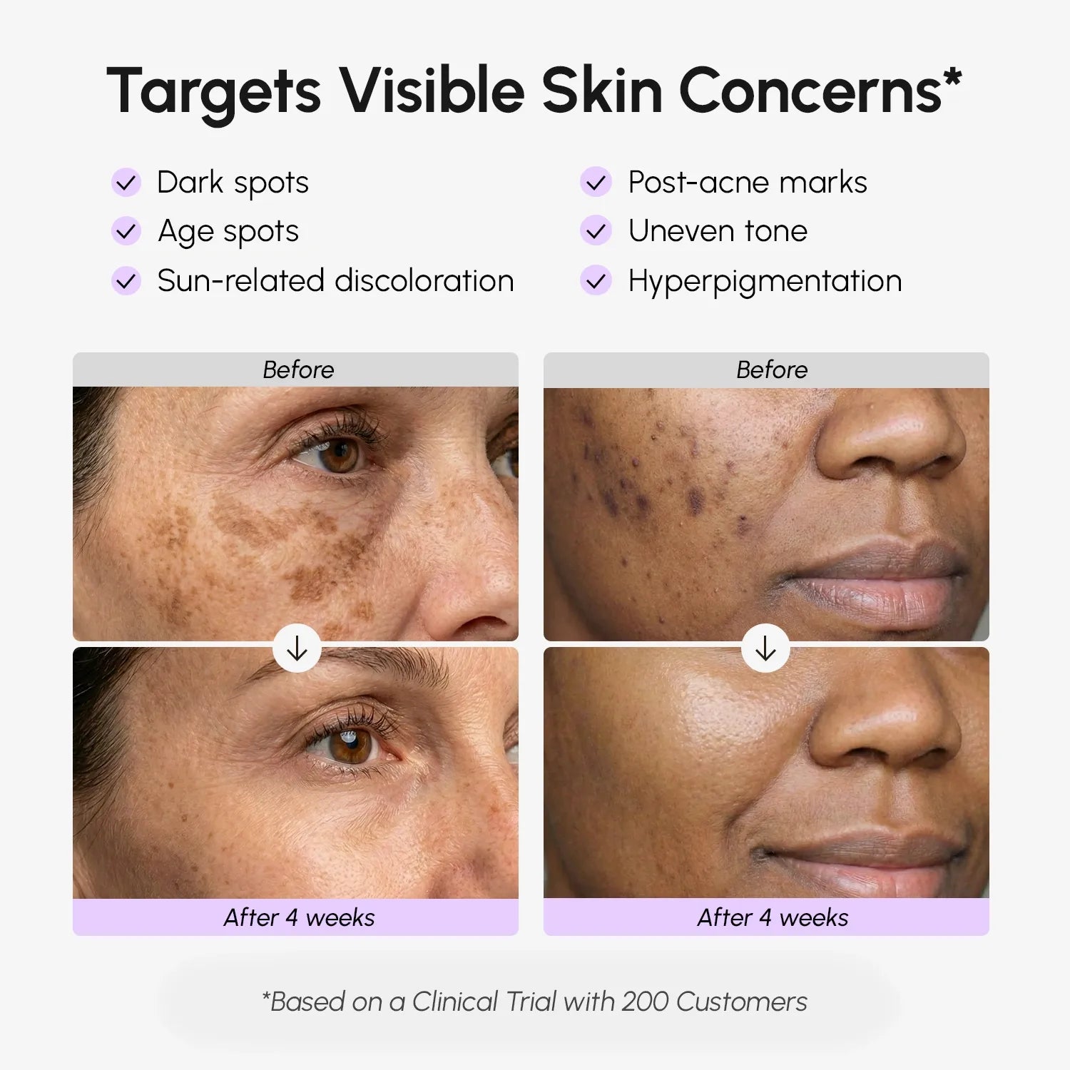 Face & Body Serum for Dark Spots - Shop PiecebyPiece